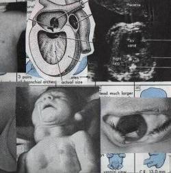 Fuck The Retarded Girl : The Dead Horse Tapes Fuck The Retarded Girl : The Dead Horse Tapes